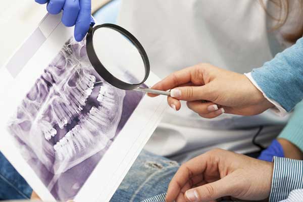 Методы диагностики в стоматологии
