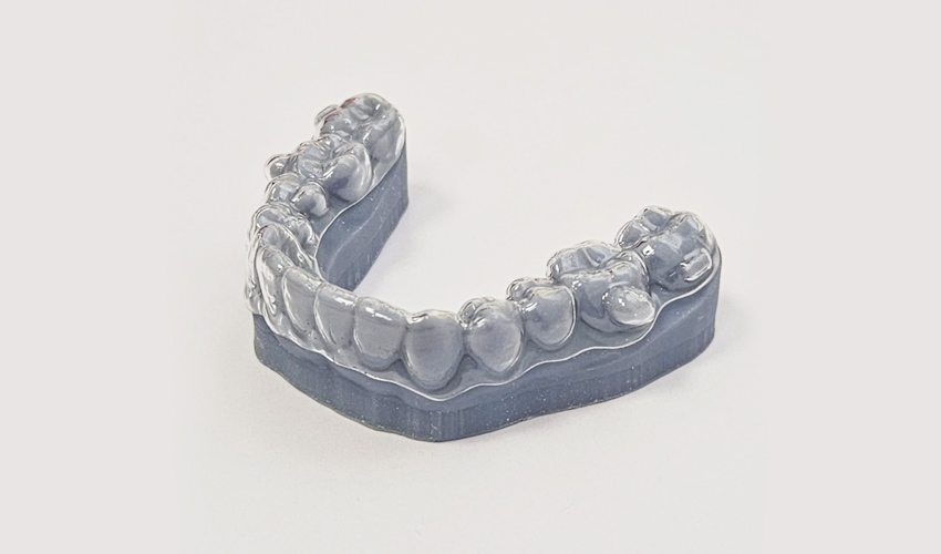 Ортодонтические каппы